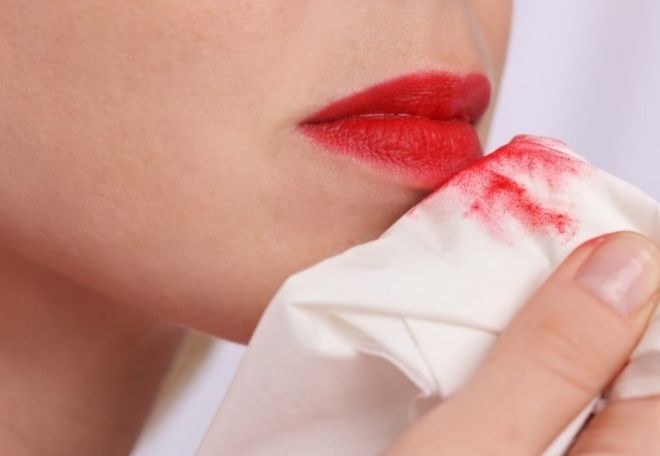 Manchas de labial en servilletas de tela, ¿cuál es la mejor forma de limpiarlas?